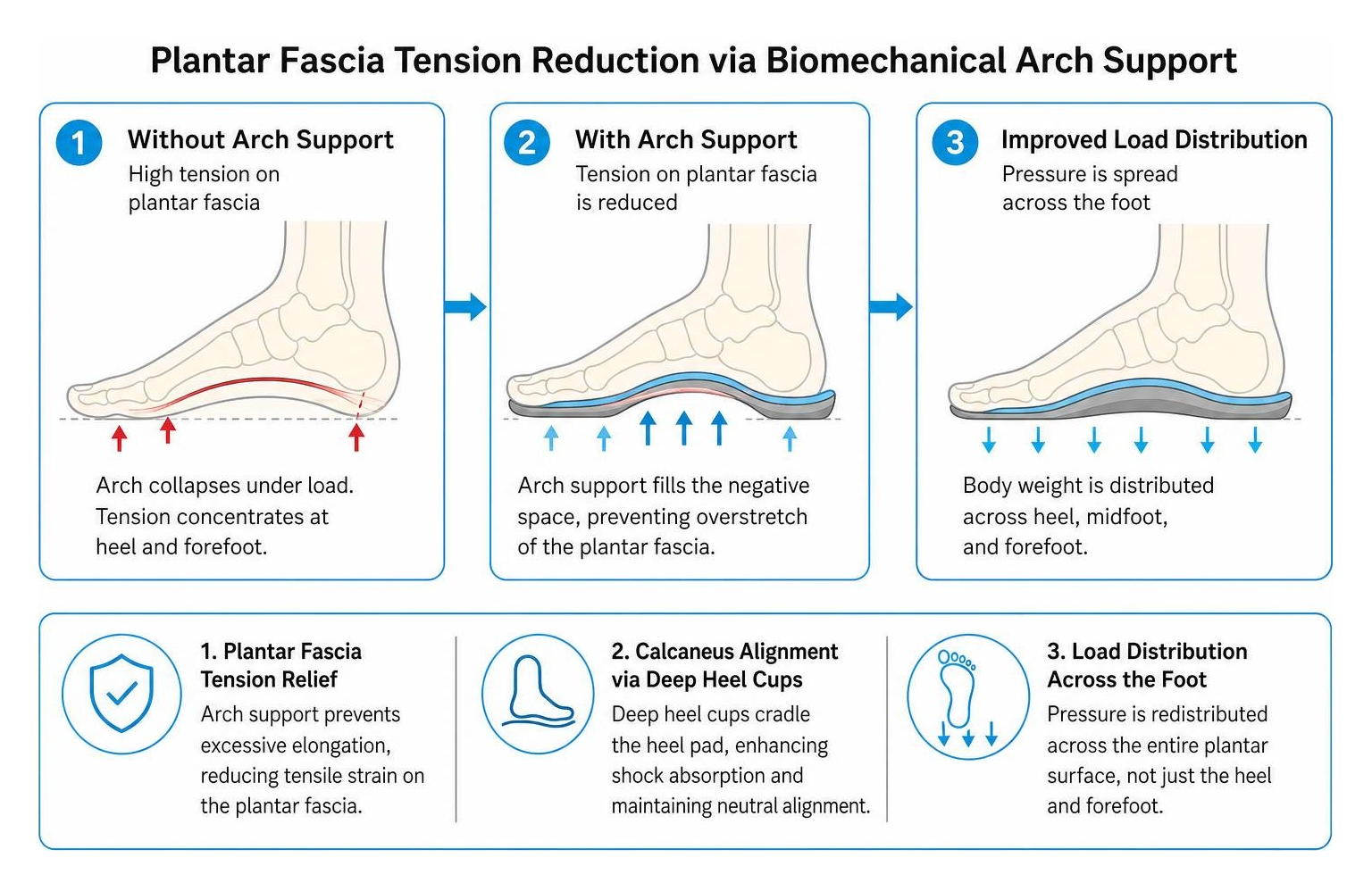 Plantar fascia tension reduction process via biomechanical arch support