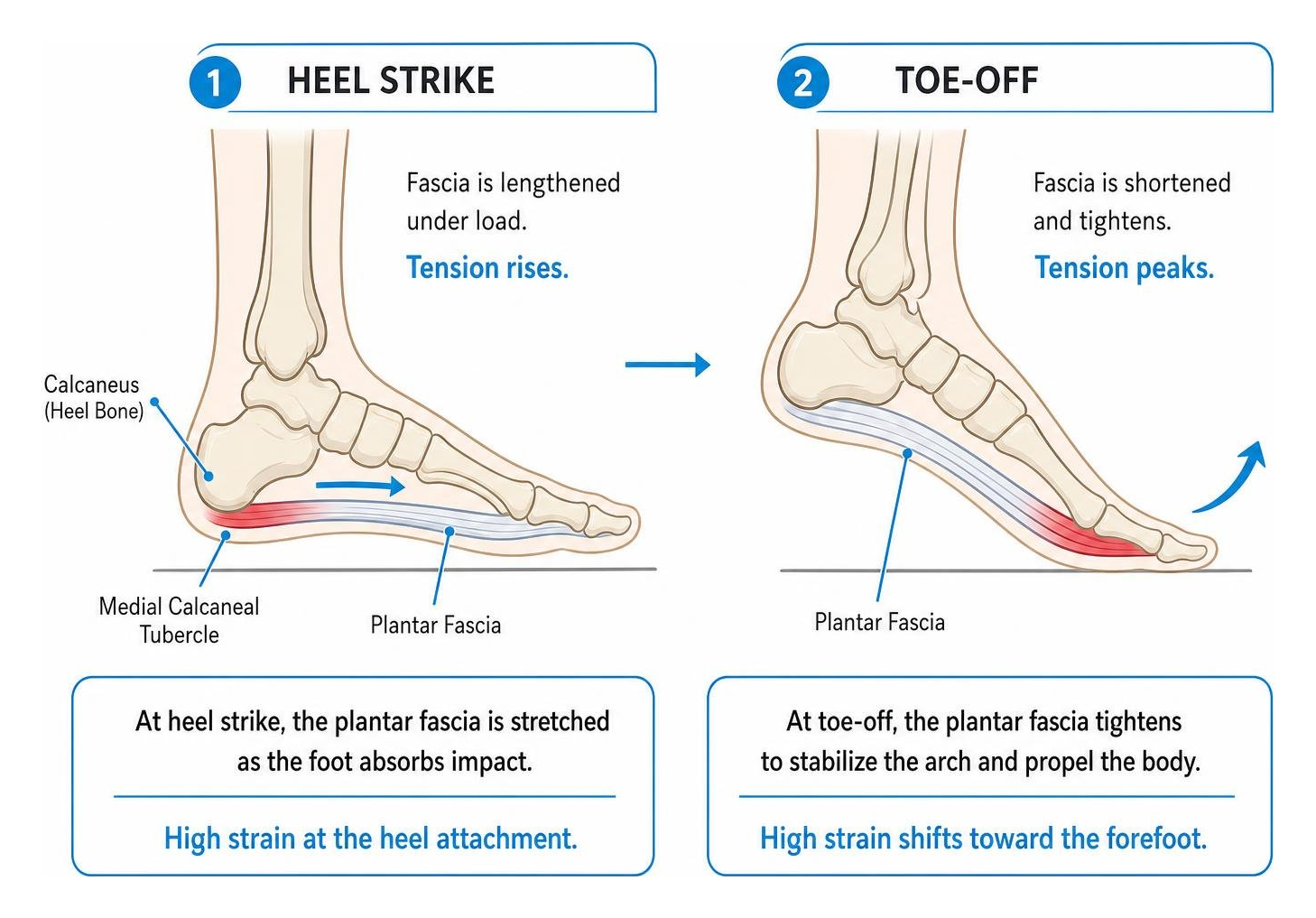 Biomechanical diagram illustrating plantar fascia strain during heel strike and toe-off Biomechanical diagram illustrating plantar fascia strain during heel strike and toe-off