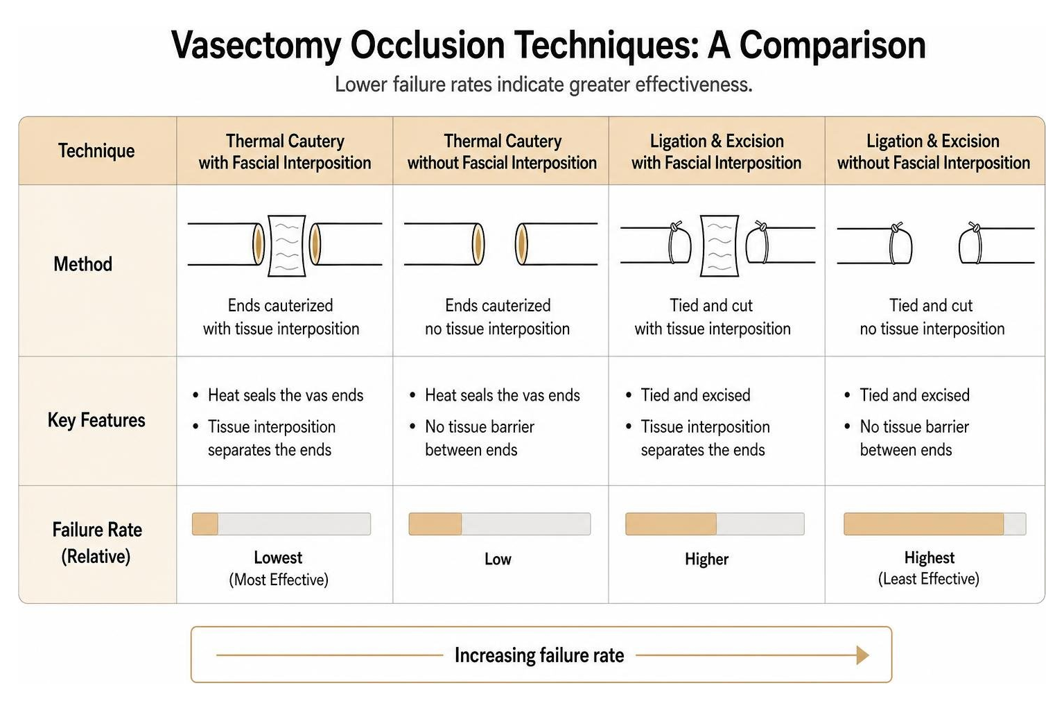comparison of vasectomy occlusion techniques and failure rates
