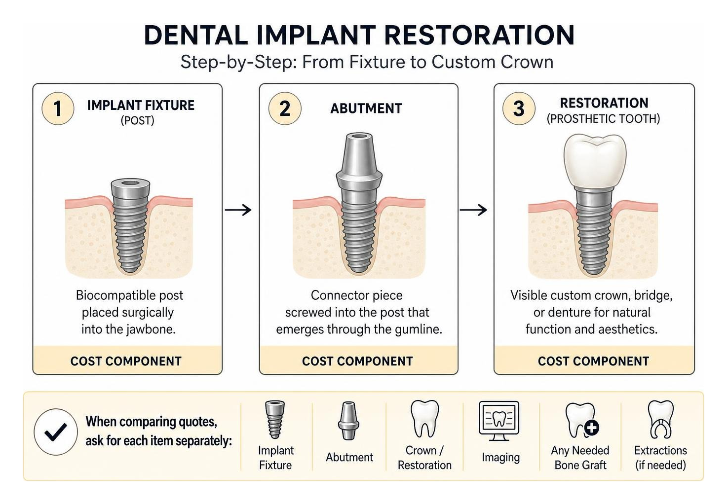 Step-by-step dental implant restoration breakdown from fixture to custom crown