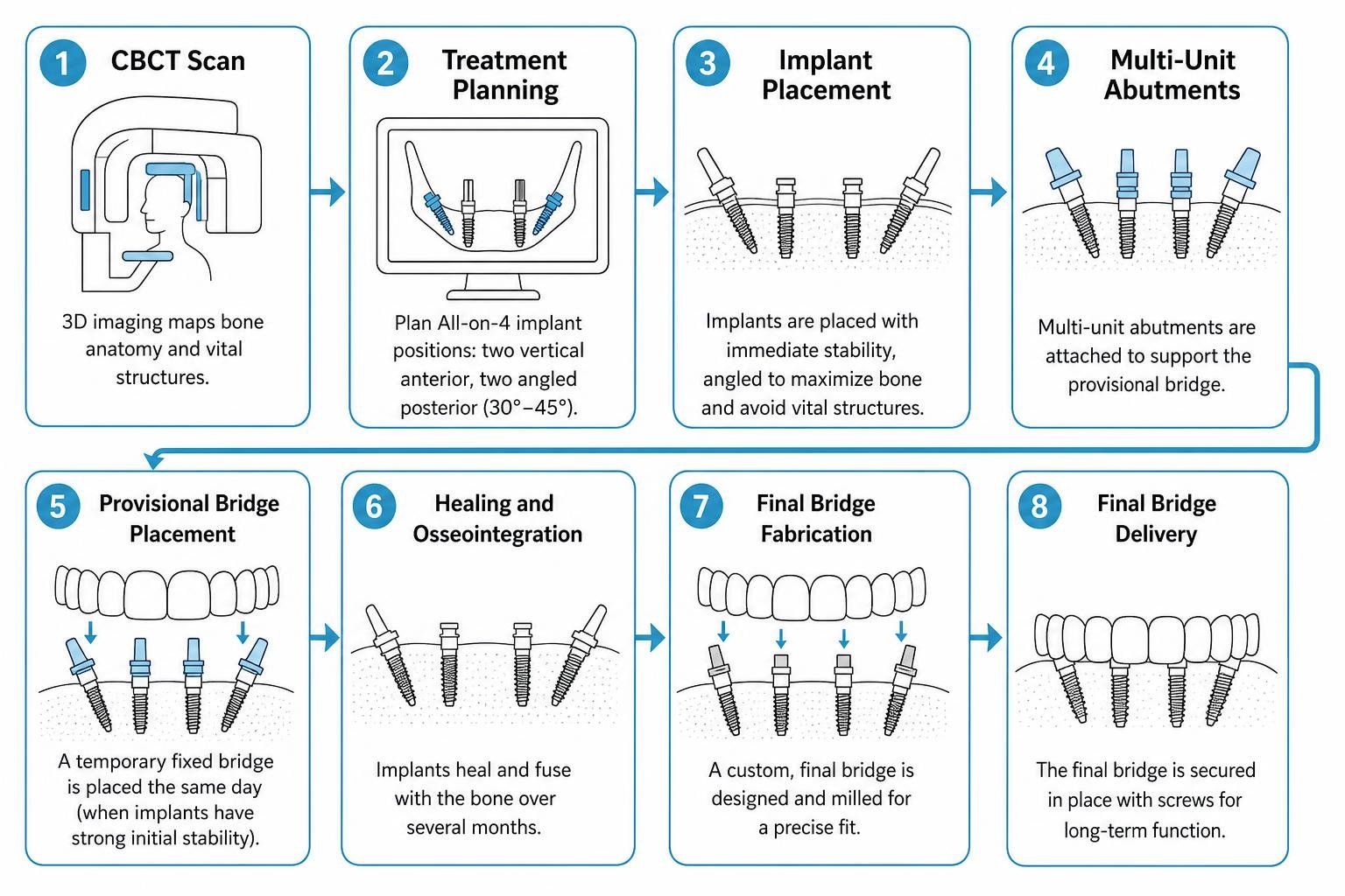 Step by step process from CBCT scan to provisional bridge delivery