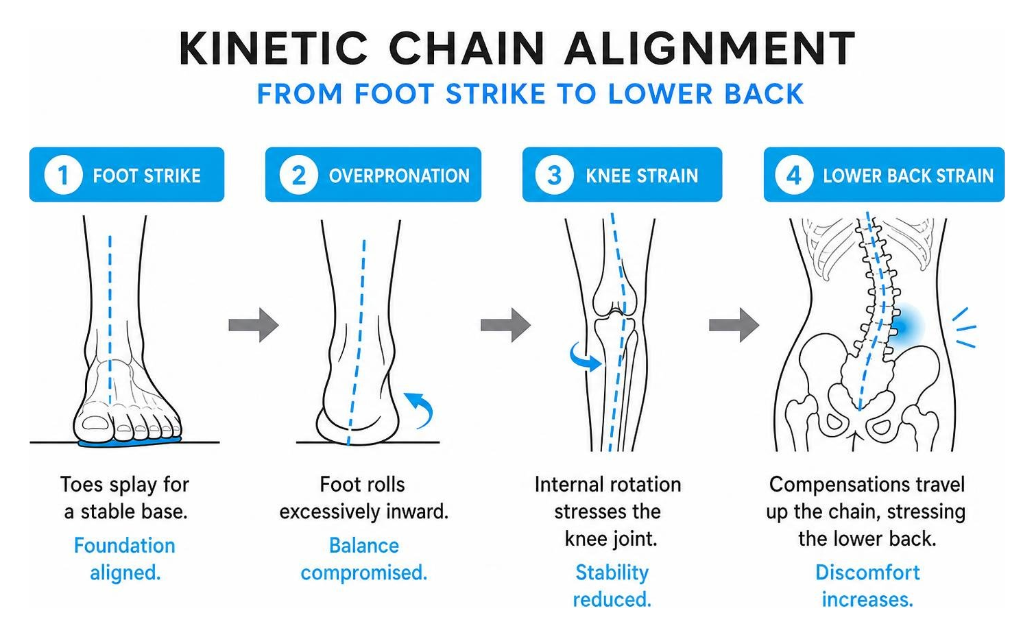 Diagram showing kinetic chain alignment from foot strike to lower back Diagram showing kinetic chain alignment from foot strike to lower back