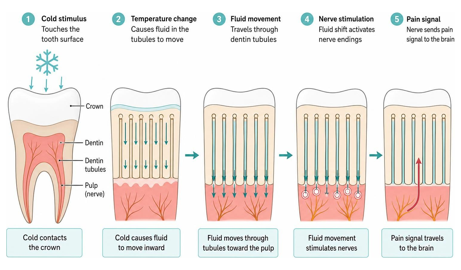 How temperature changes travel through dentin tubules to stimulate the nerve