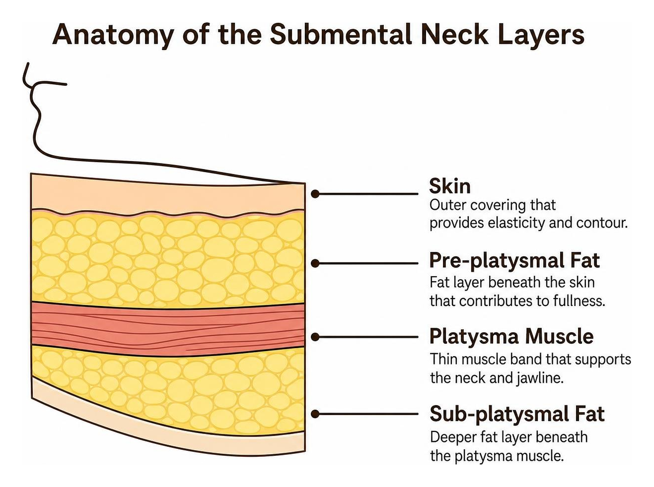 Anatomy of the submental neck layers showing fat, platysma muscle, and skin