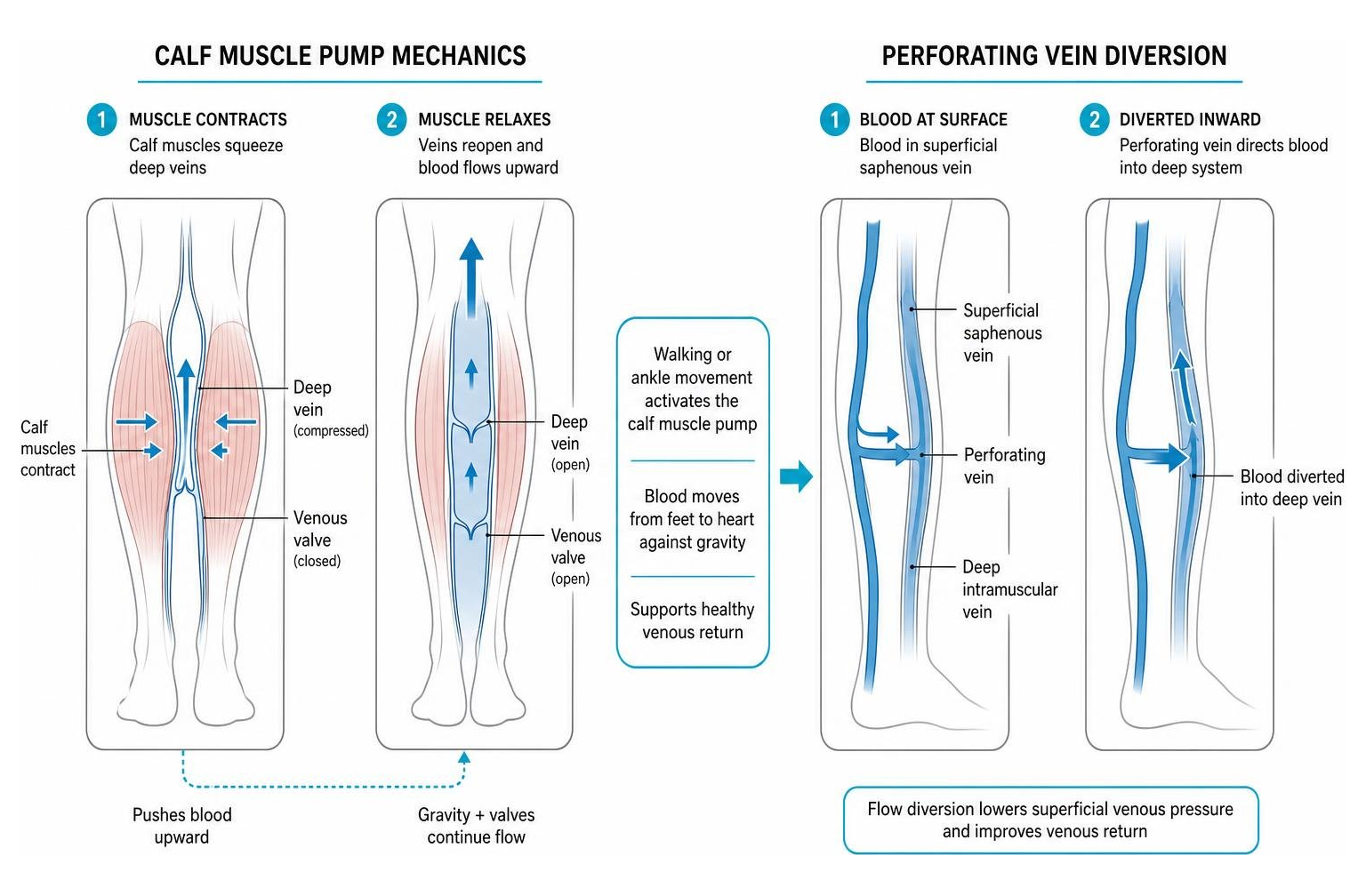 Mechanics of the calf muscle pump and perforating vein diversion