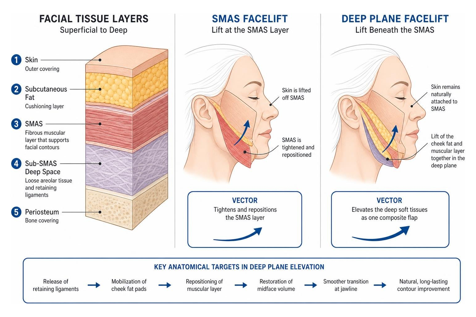 Anatomy diagram of facial tissue layers and deep plane vector repositioning