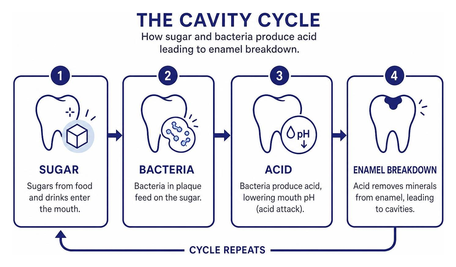 The cavity cycle showing how sugar and bacteria produce acid leading to enamel breakdown