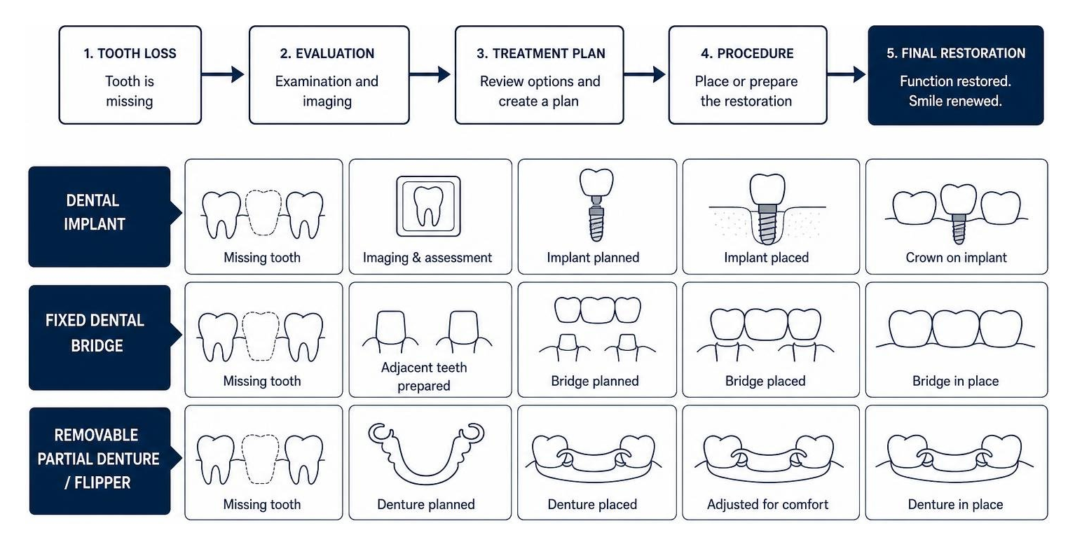 Diagram showing treatment options process from tooth loss to final restoration