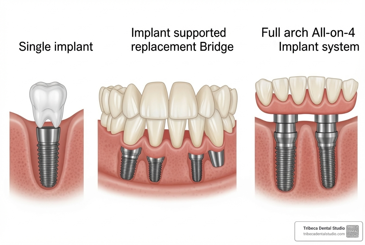 illustration of the difference between a single implant, an implant bridge, and All-on-4 - dental implants cost illustration of the difference between a single implant, an implant bridge, and All-on-4 - dental implants cost