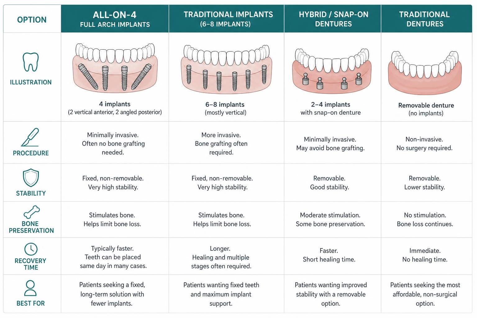 Diagram comparing full arch implant options and traditional replacement methods