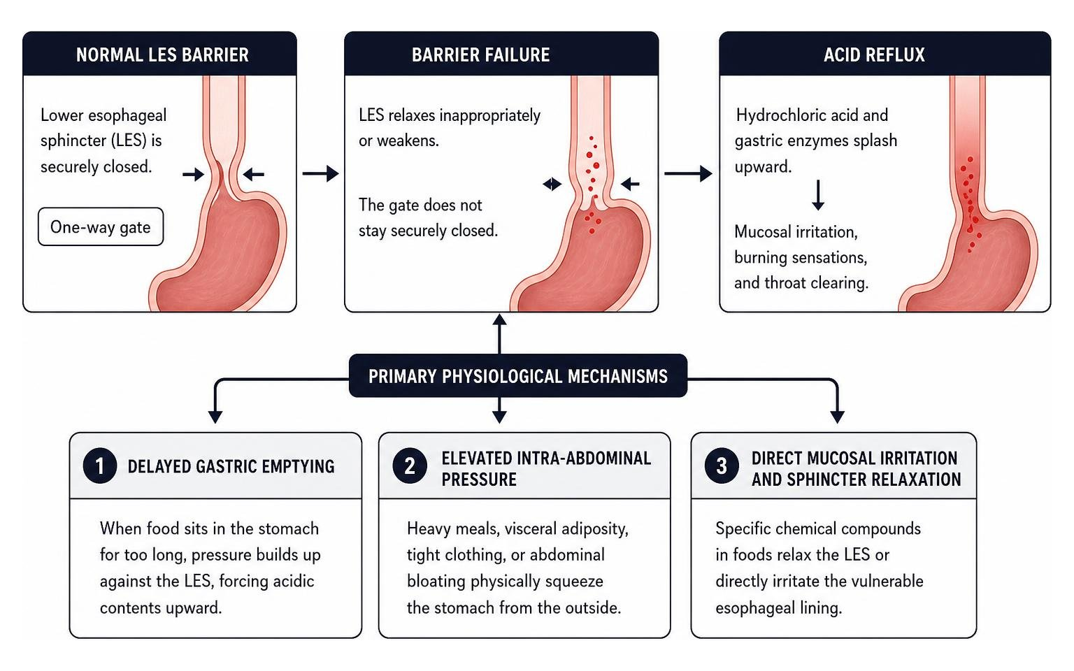 mechanism of lower esophageal sphincter barrier and reflux triggers