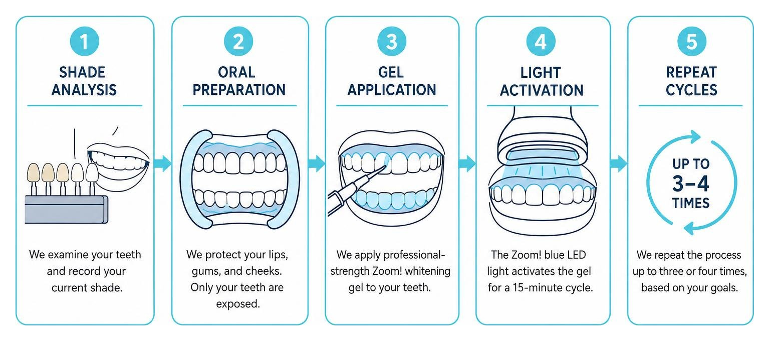 Step-by-step sequence of the in-office Zoom whitening treatment Step-by-step sequence of the in-office Zoom whitening treatment