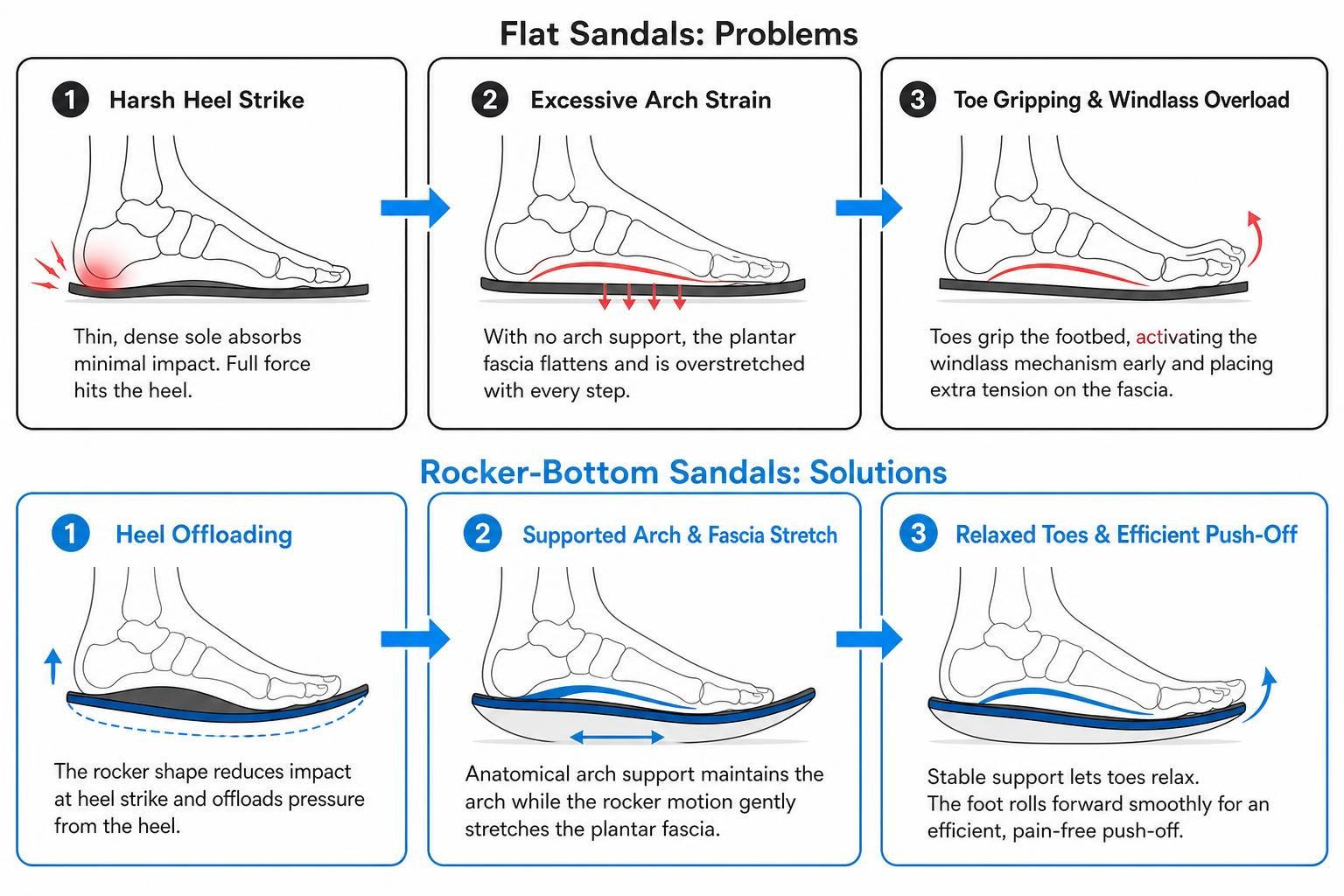 Biomechanics of rocker-bottom sandals showing heel offloading and fascia stretch