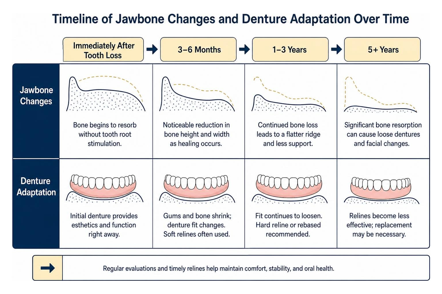 Timeline of jawbone changes and denture adaptation over time