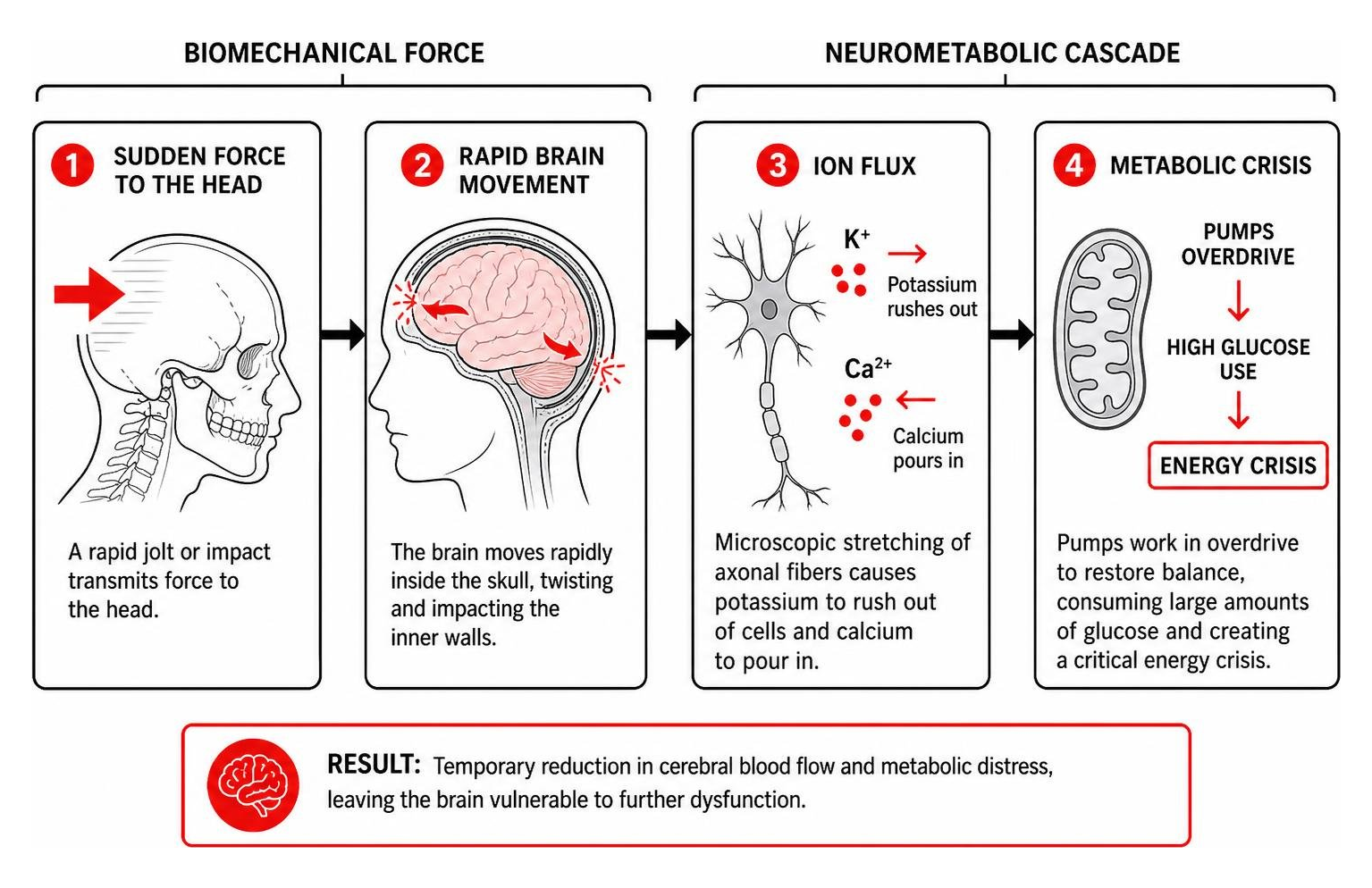 Biomechanical force causing rapid brain movement and metabolic crisis inside the skull Biomechanical force causing rapid brain movement and metabolic crisis inside the skull