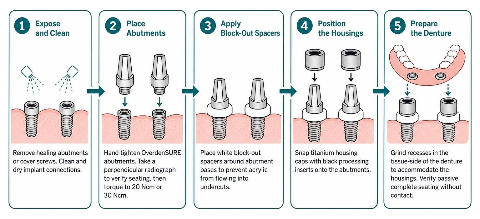 Process diagram for direct chairside overdenture pickup