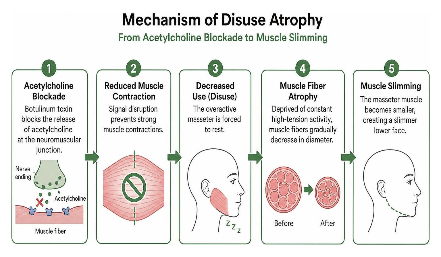 Mechanism of disuse atrophy from acetylcholine blockade to muscle slimming Mechanism of disuse atrophy from acetylcholine blockade to muscle slimming