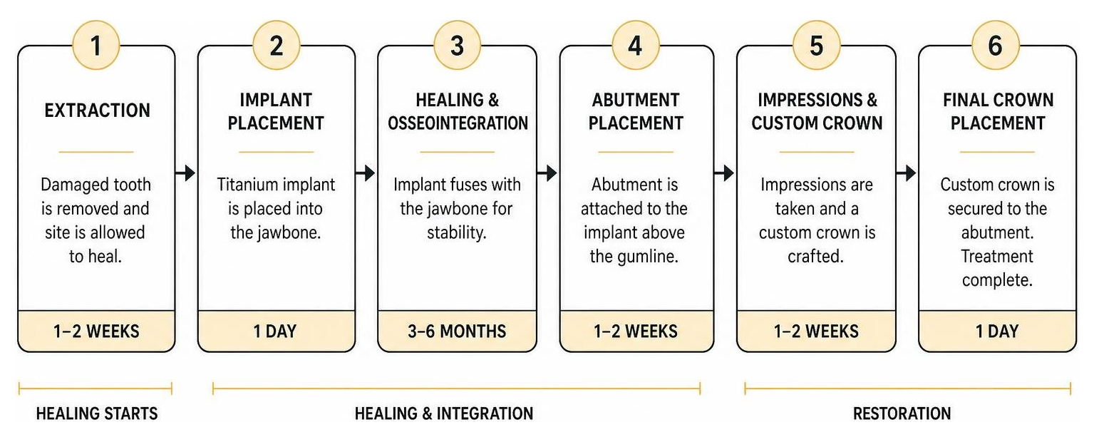 Timeline of the dental implant process from extraction to final crown Timeline of the dental implant process from extraction to final crown