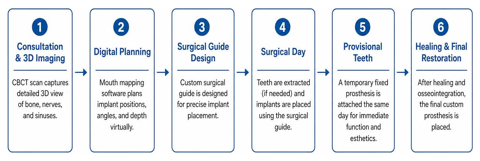 Diagram of the full arch implant digital planning workflow