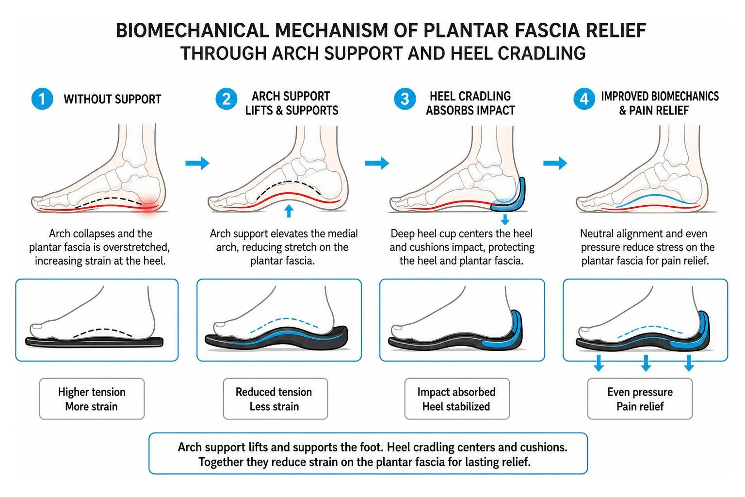 Biomechanical mechanism of plantar fascia relief through arch support and heel cradling Biomechanical mechanism of plantar fascia relief through arch support and heel cradling