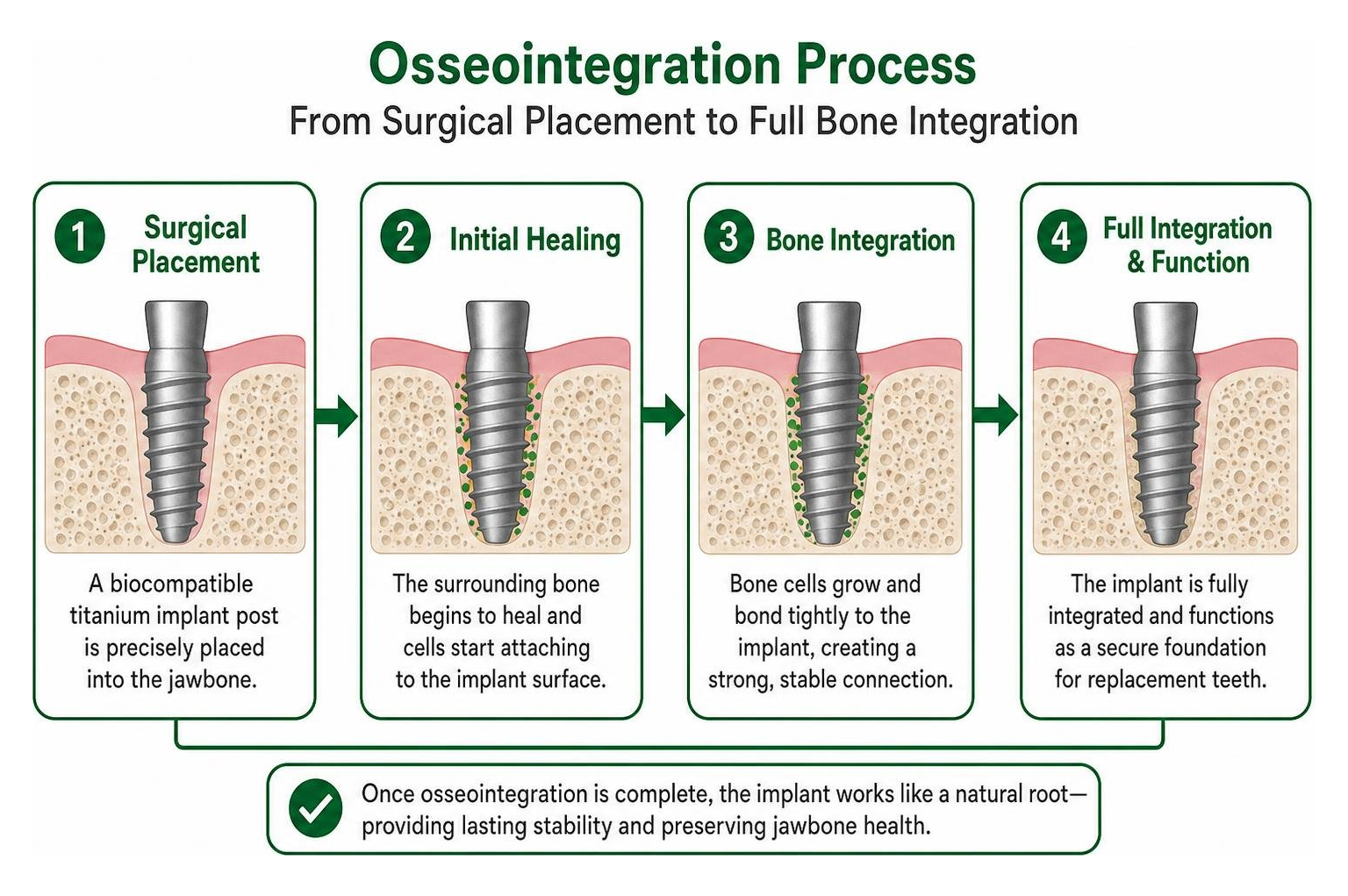 Step-by-step osseointegration process from surgical placement to full bone integration
