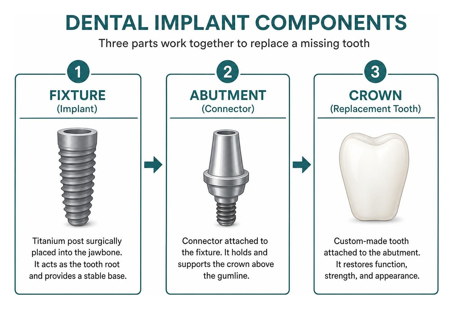 breakdown of dental implant components showing fixture abutment and crown breakdown of dental implant components showing fixture abutment and crown