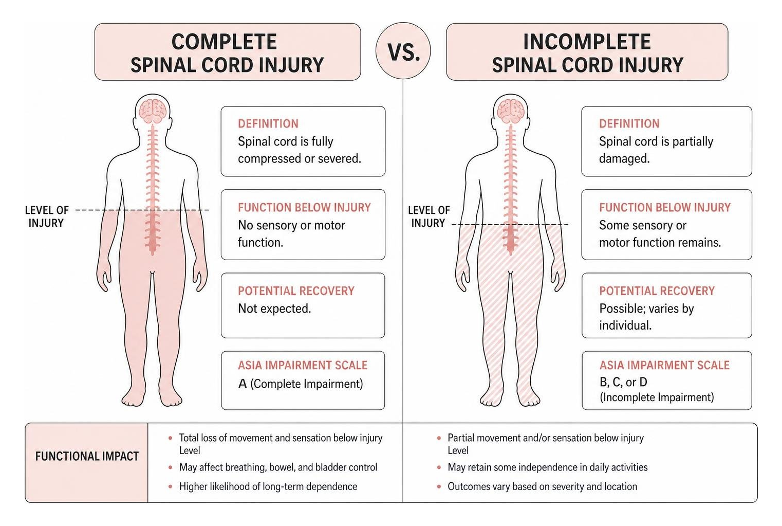 Diagram comparing complete versus incomplete spinal cord injuries and their functional impacts Diagram comparing complete versus incomplete spinal cord injuries and their functional impacts