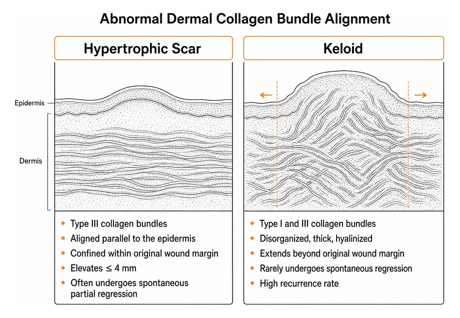 abnormal dermal collagen bundle alignment abnormal dermal collagen bundle alignment