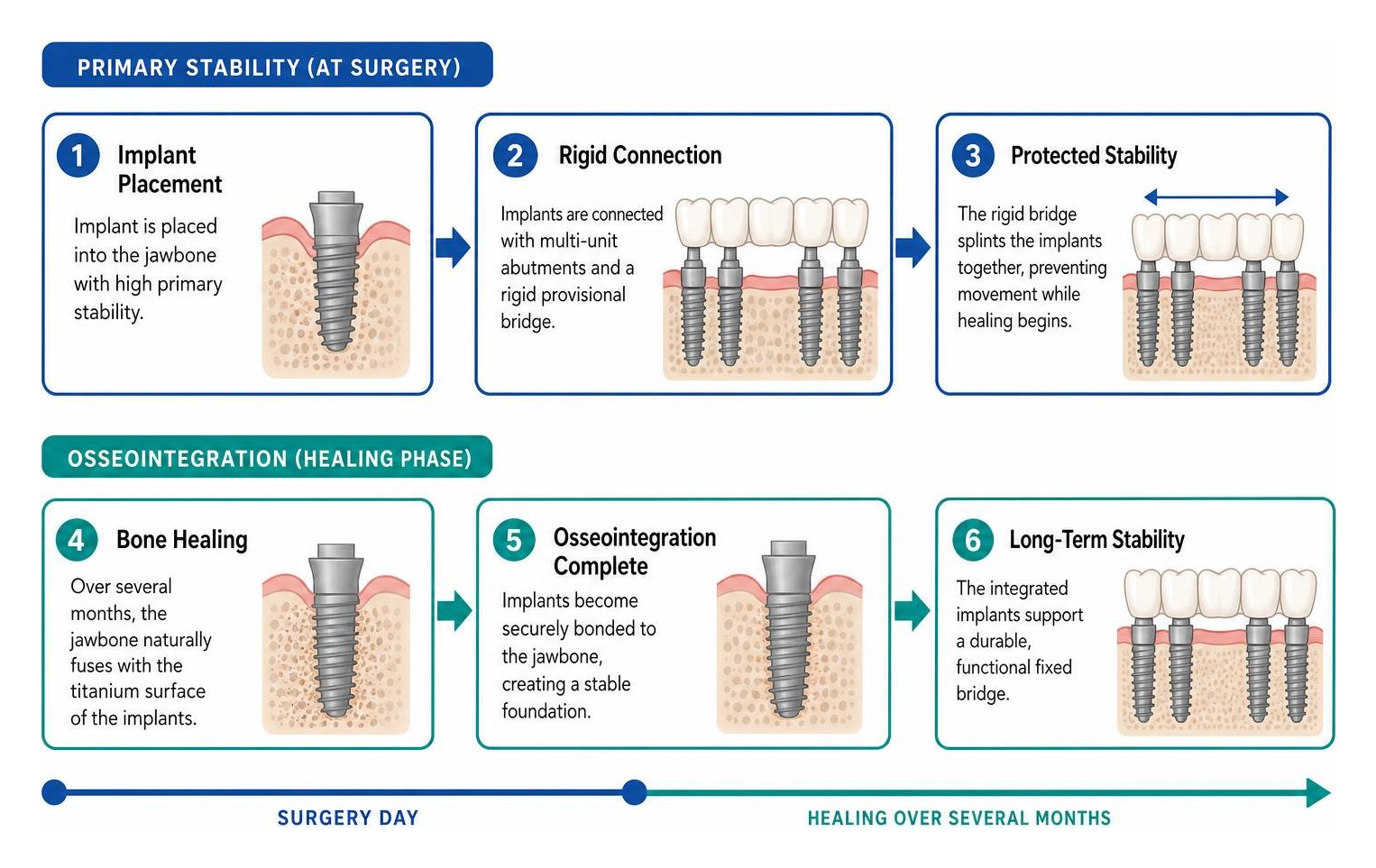 osseointegration and primary stability process