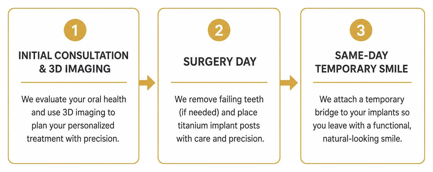 Step-by-step process diagram of full mouth dental implant treatment Step-by-step process diagram of full mouth dental implant treatment
