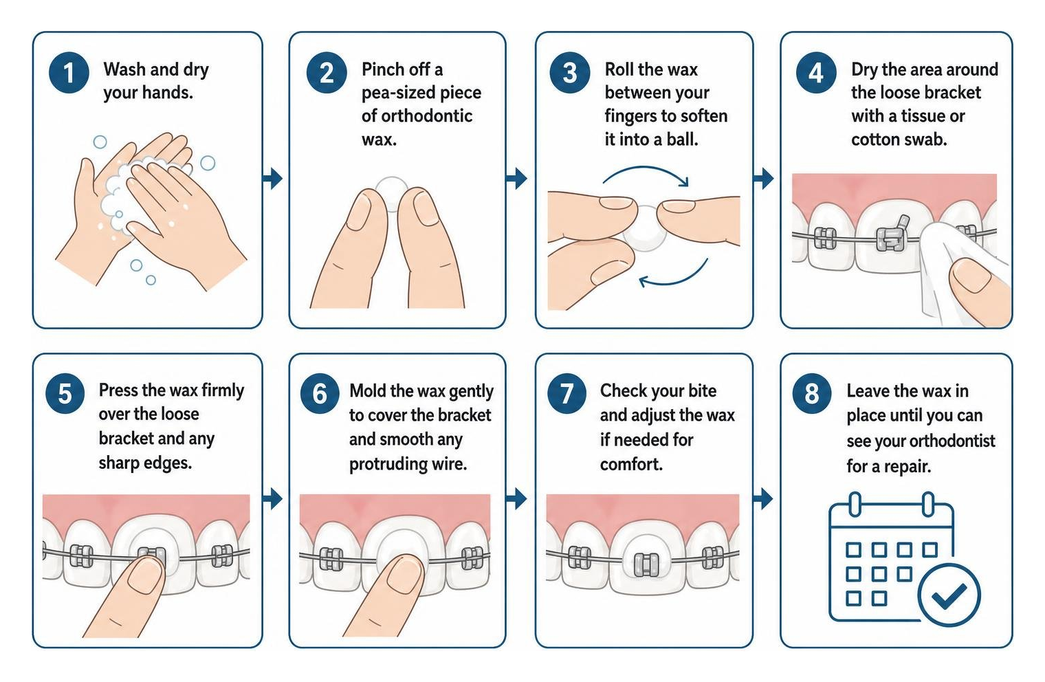 step by step guide for applying orthodontic wax to a loose bracket