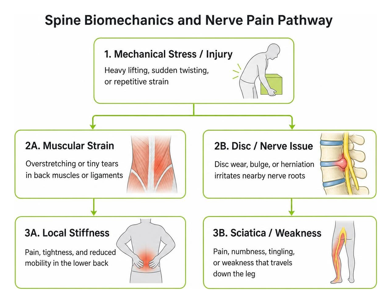 Spine biomechanics and nerve pain pathway Spine biomechanics and nerve pain pathway