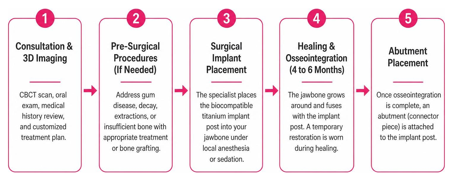 Step-by-step dental implant journey from consultation to final restoration Step-by-step dental implant journey from consultation to final restoration
