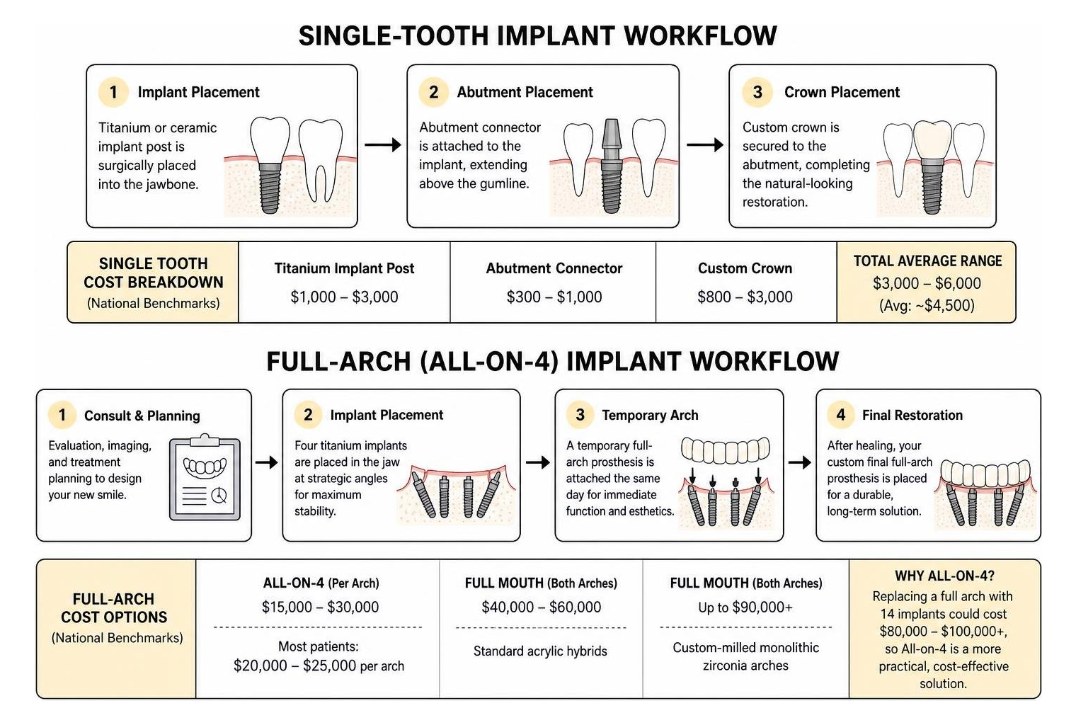 Step-by-step full-arch and single-tooth dental implant placement workflow