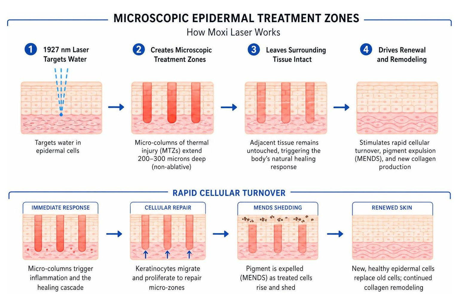 Microscopic epidermal treatment zones and rapid cellular turnover