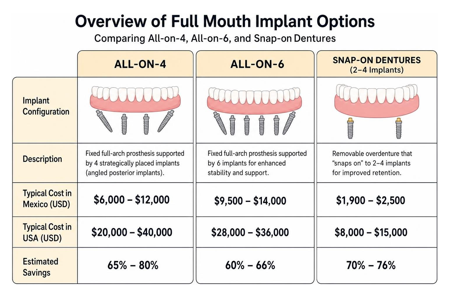 Overview of full mouth implant options comparing All-on-4, All-on-6, and Snap-on dentures