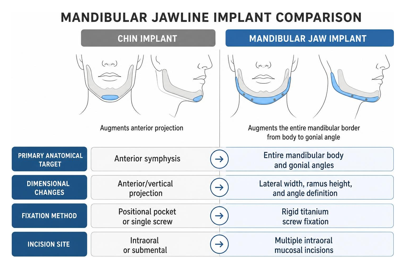 Mandibular jawline implant comparison diagram