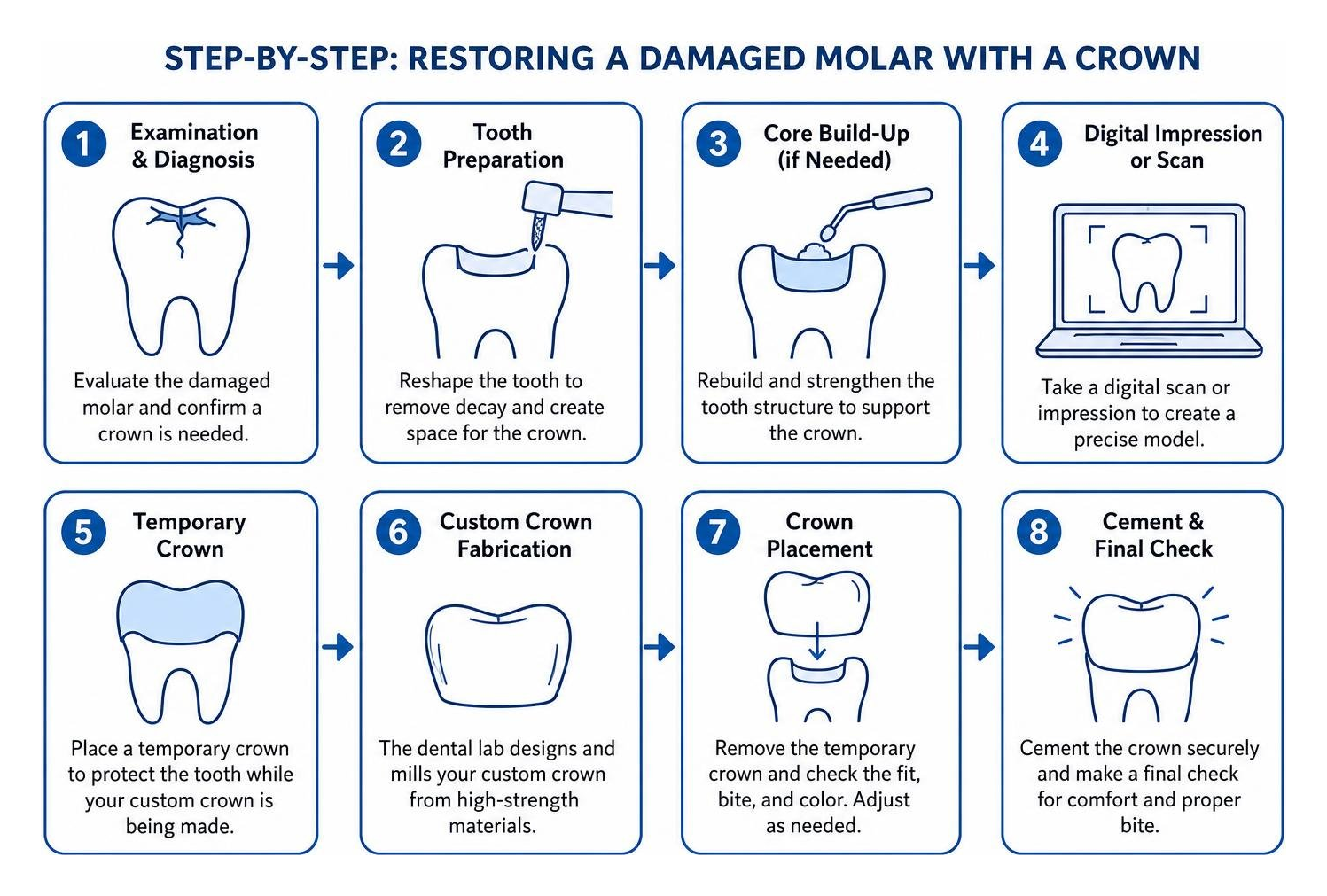 Step-by-step clinical process of restoring a damaged molar with a crown Step-by-step clinical process of restoring a damaged molar with a crown