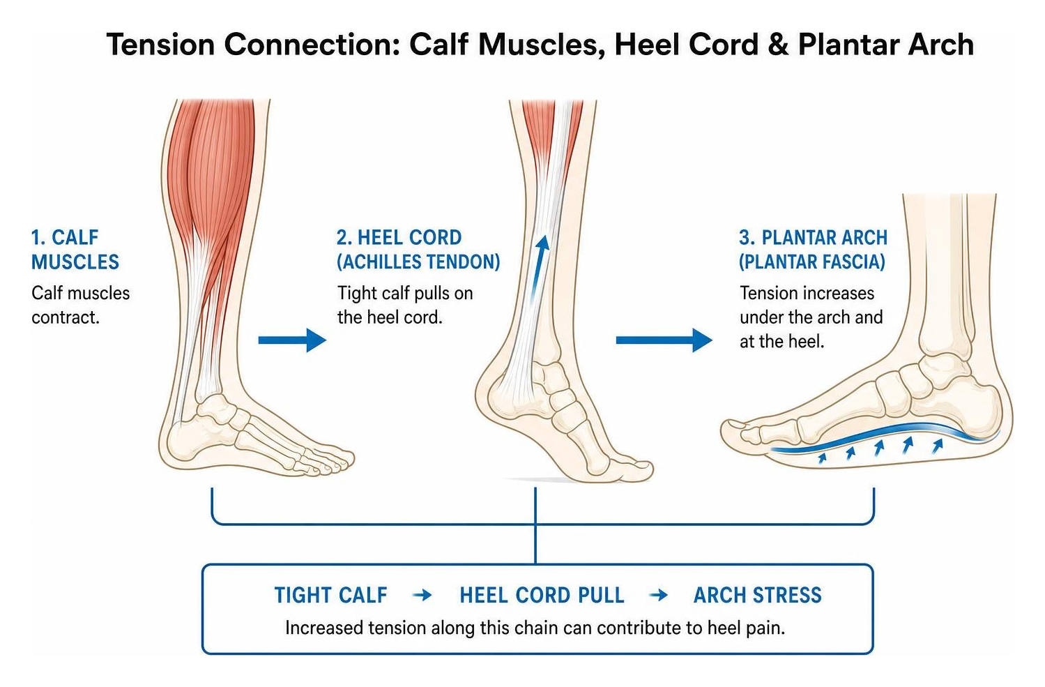 diagram illustrating tension connection between calf muscles, heel cord, and plantar arch diagram illustrating tension connection between calf muscles, heel cord, and plantar arch