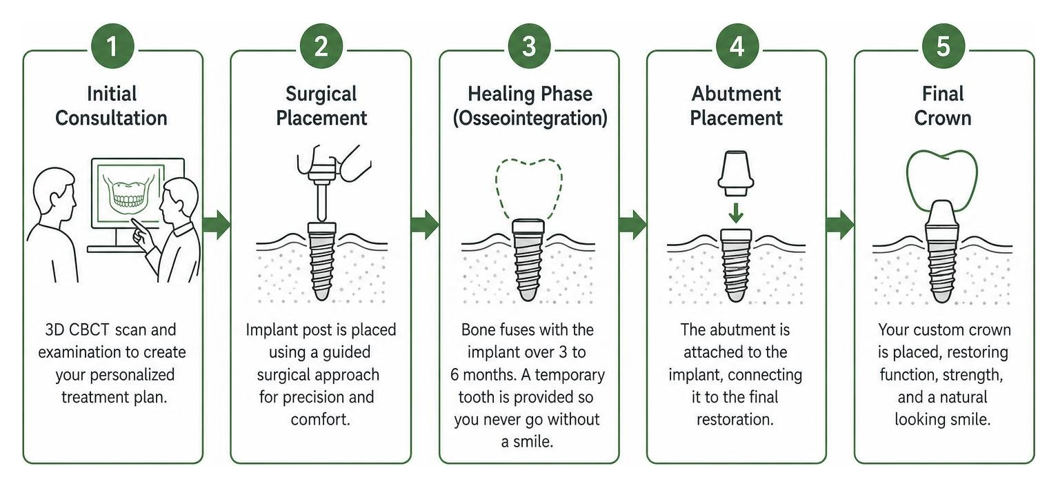 a diagram of the step-by-step dental implant timeline from consultation to final crown