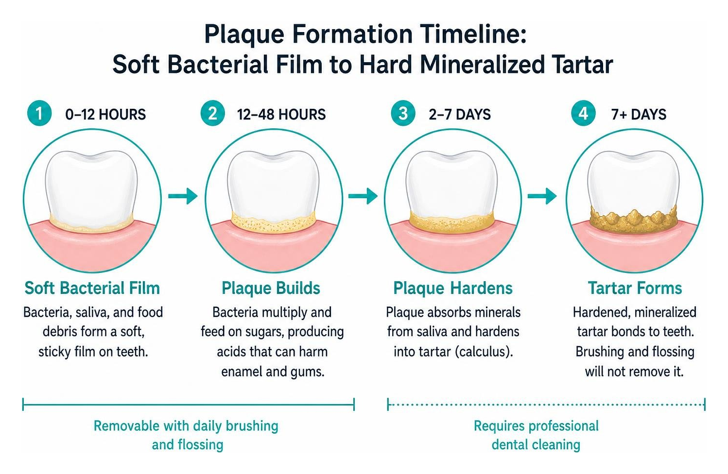Plaque formation timeline: soft bacterial film to hard mineralized tartar
