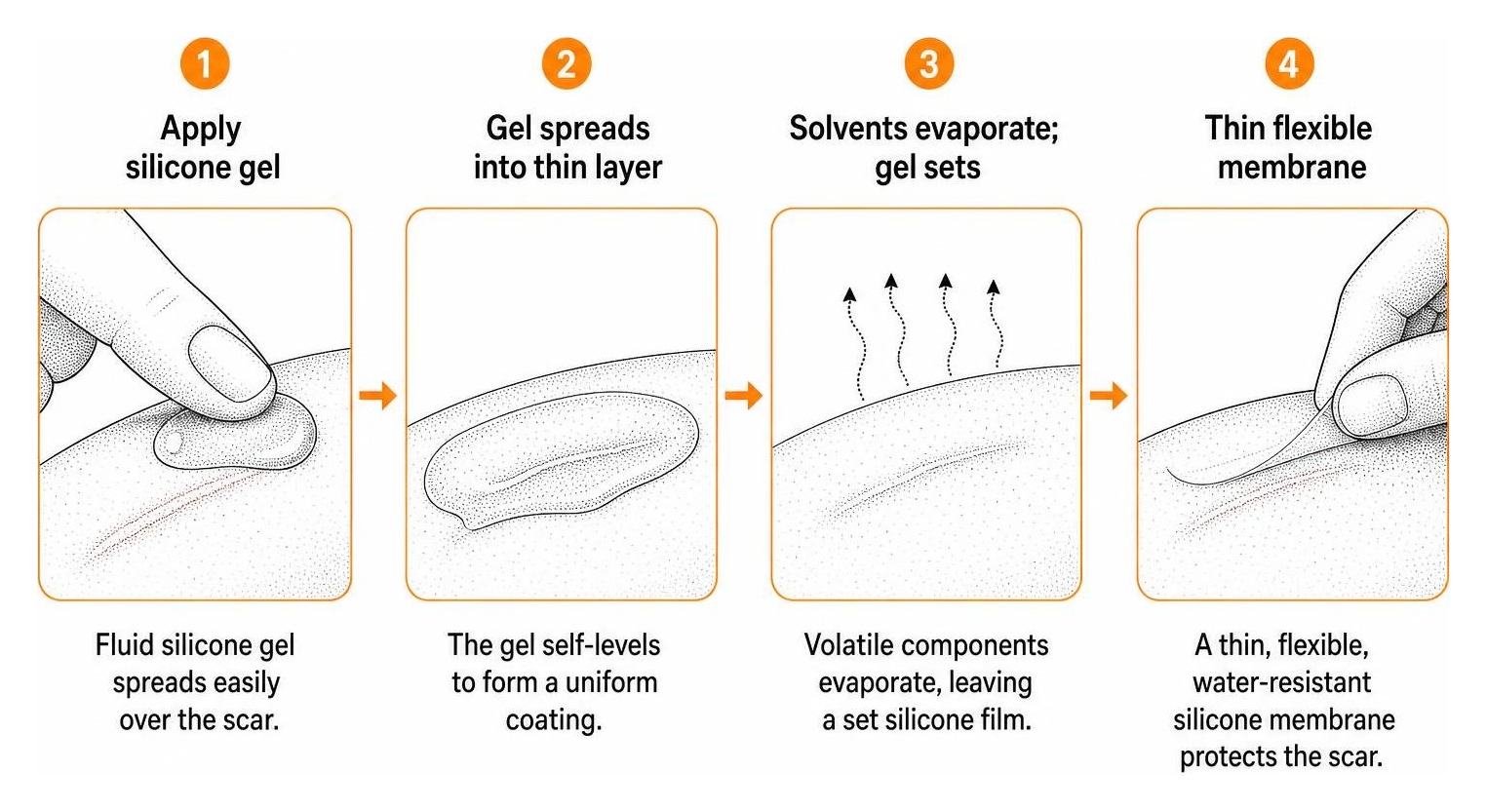 diagram of silicone gel drying into a thin flexible membrane diagram of silicone gel drying into a thin flexible membrane