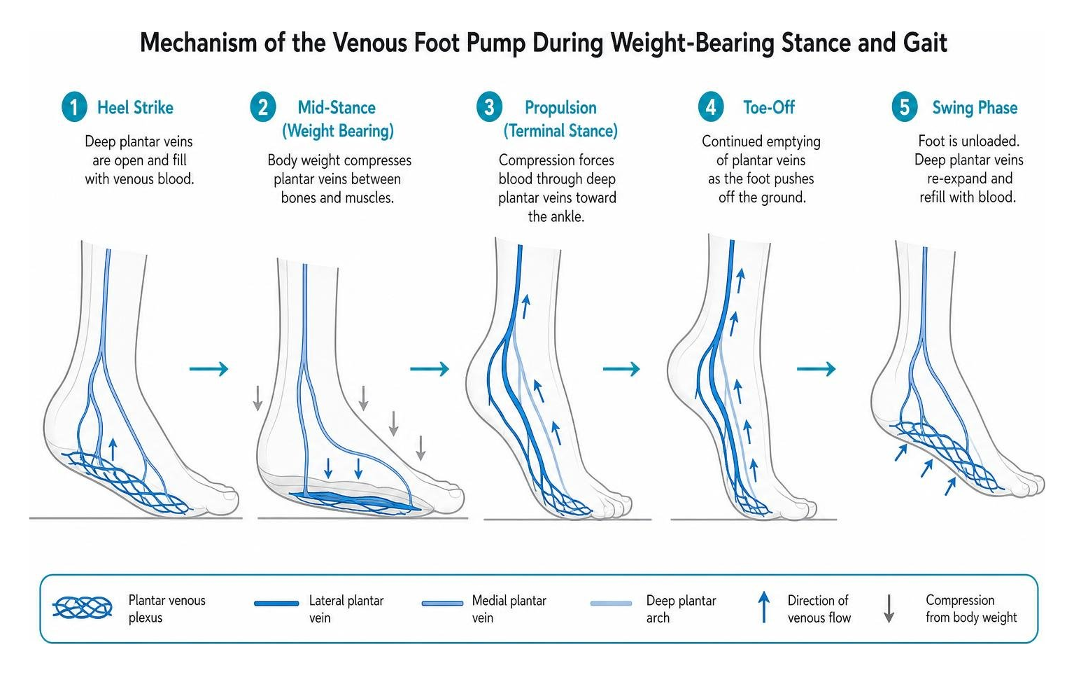 Diagram showing the mechanism of the venous foot pump during weight-bearing stance and gait