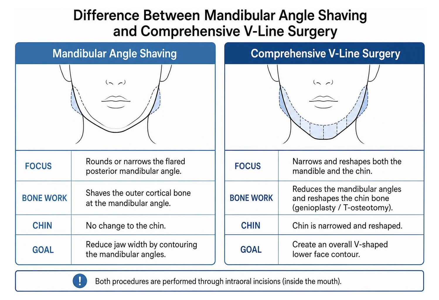 Difference between mandibular angle shaving and comprehensive V-line surgery