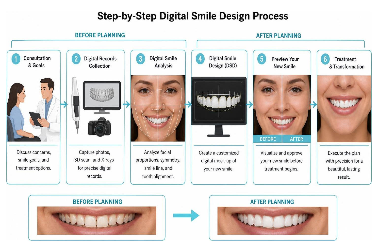 Step-by-step digital smile design process showing before and after planning Step-by-step digital smile design process showing before and after planning