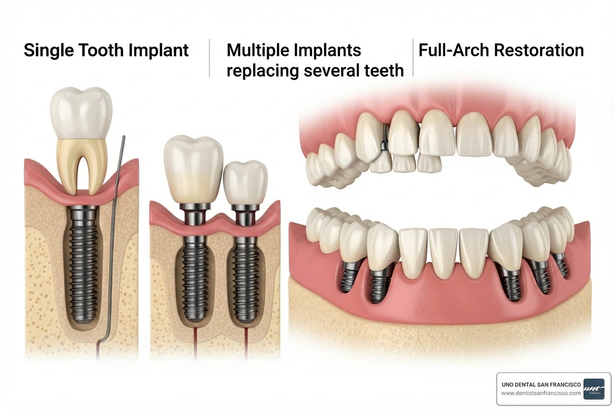 diagram showing single, multiple, and full-arch implants - Experienced implant dentist diagram showing single, multiple, and full-arch implants - Experienced implant dentist