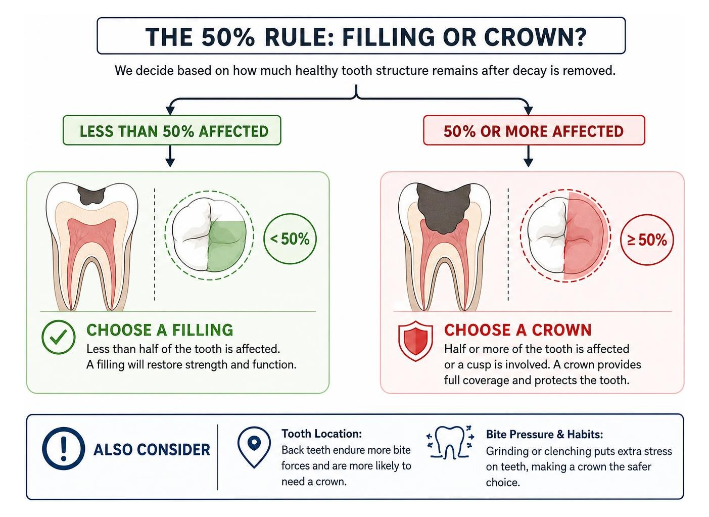 Diagram illustrating the 50% Rule for choosing between filling and crown