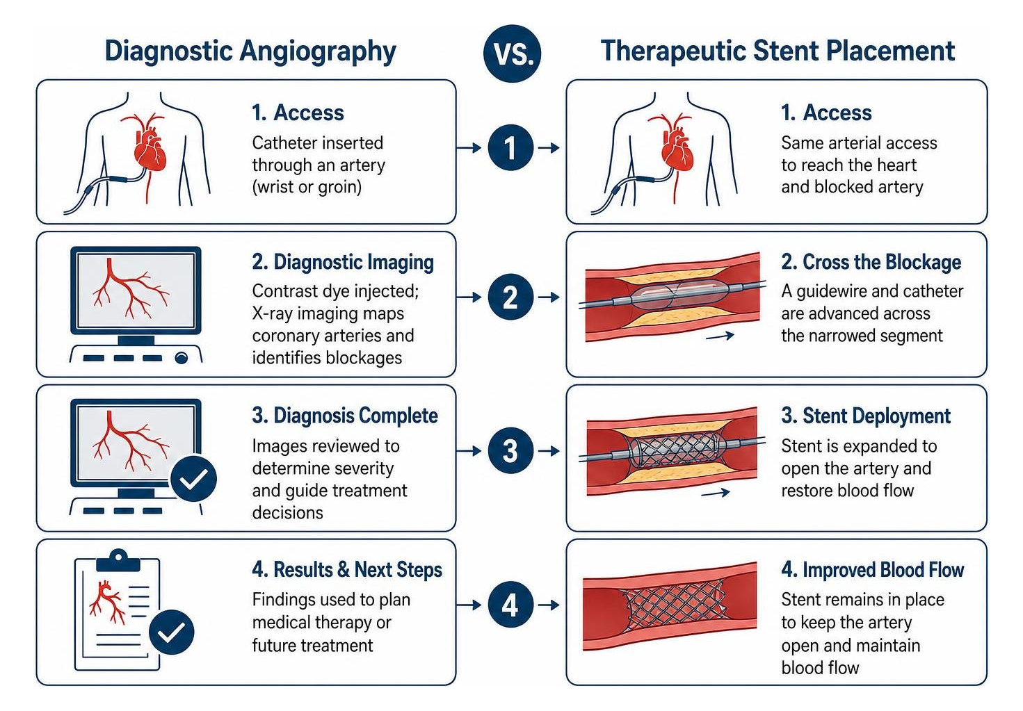 Comparison diagram of diagnostic angiography versus therapeutic stent placement Comparison diagram of diagnostic angiography versus therapeutic stent placement