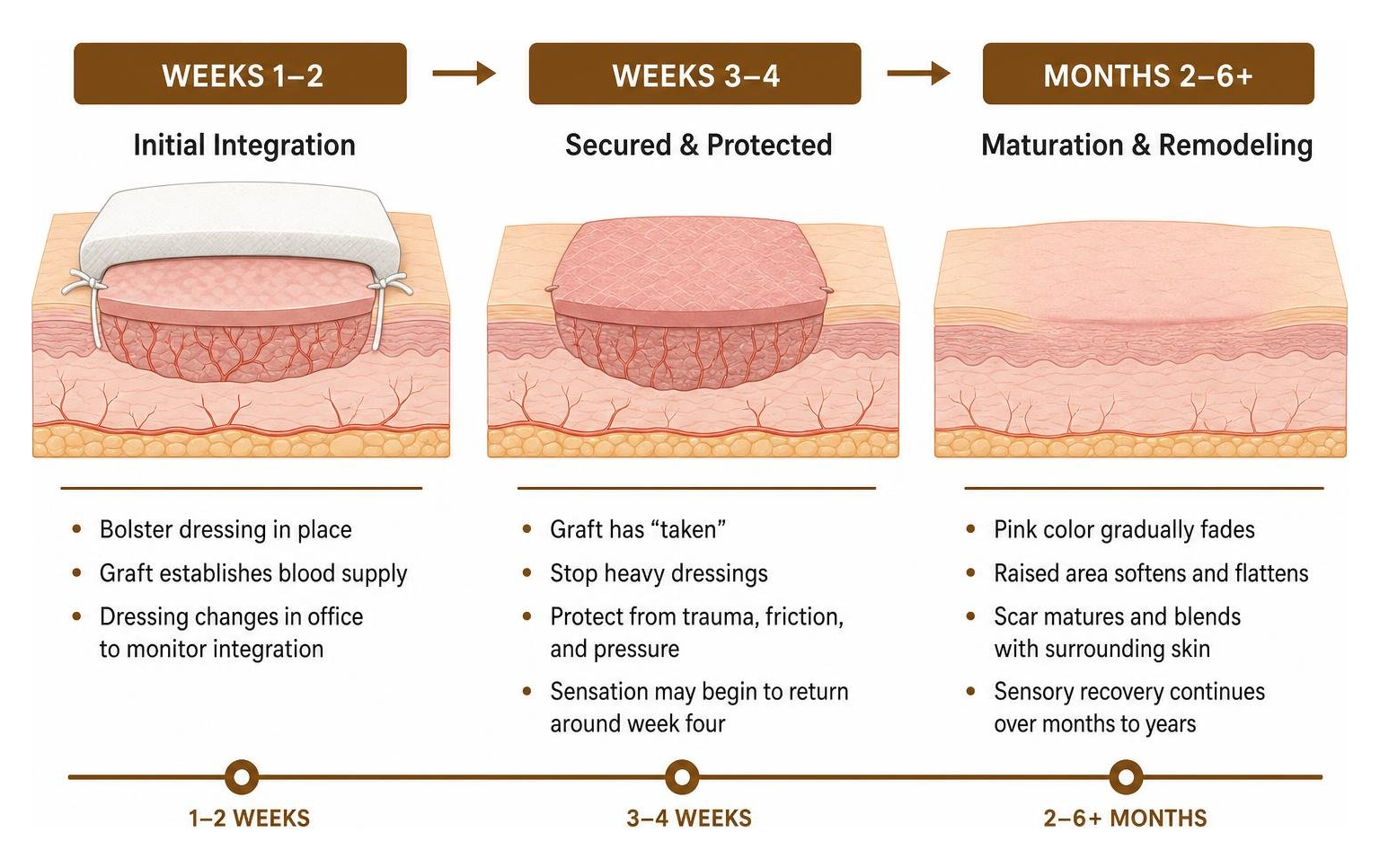 Diagram of skin graft healing stages and tissue integration