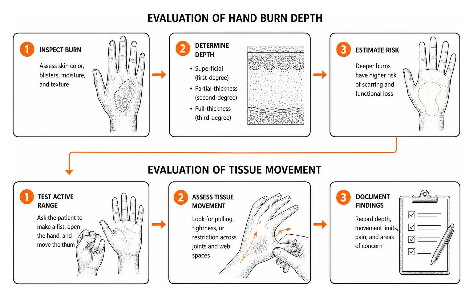 evaluation of hand burn depth and tissue movement evaluation of hand burn depth and tissue movement